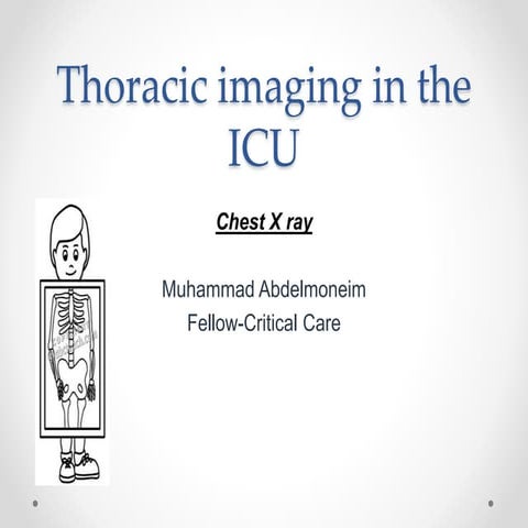Thoracic imaging in icu