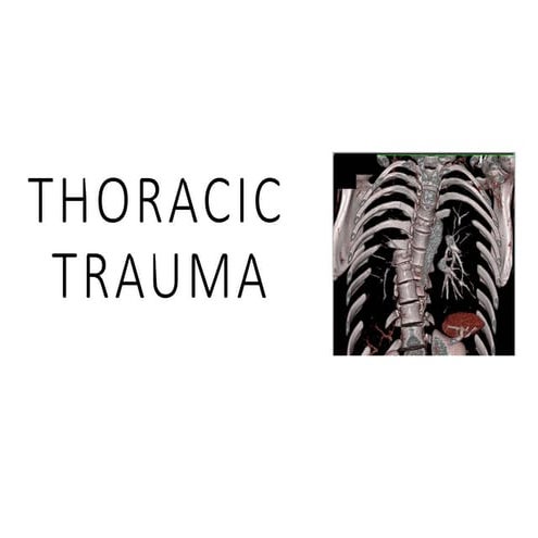 Thoracic and cardiovascular trauma surgery.pptx