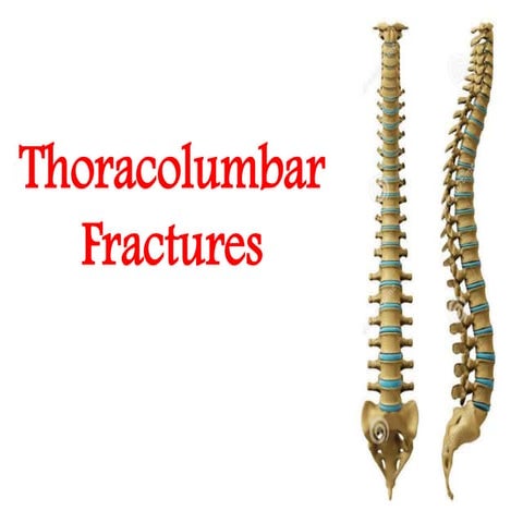 Thoraco lumbar fractures