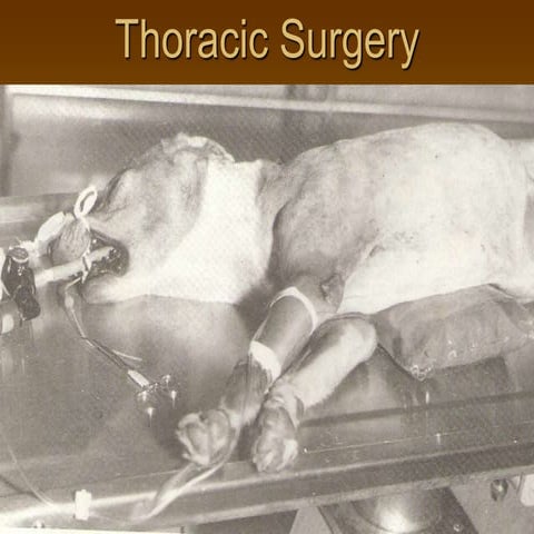 Thoracic Surgery