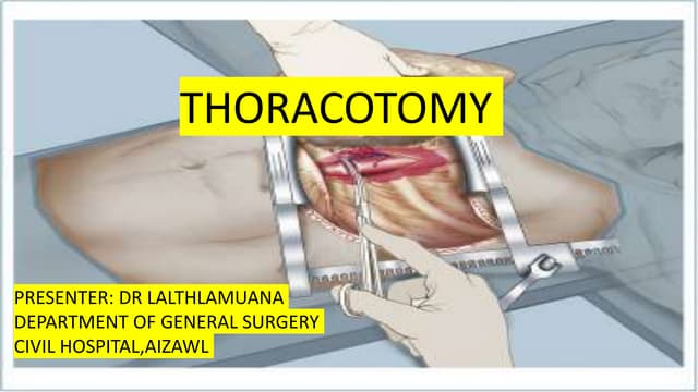 Thoracotomy | PPTX