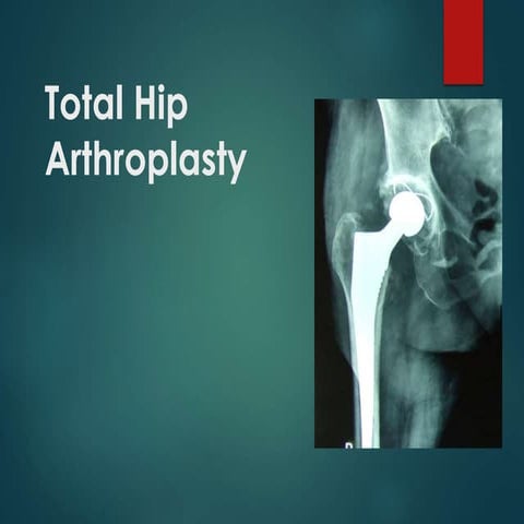 total hip arthroplasty