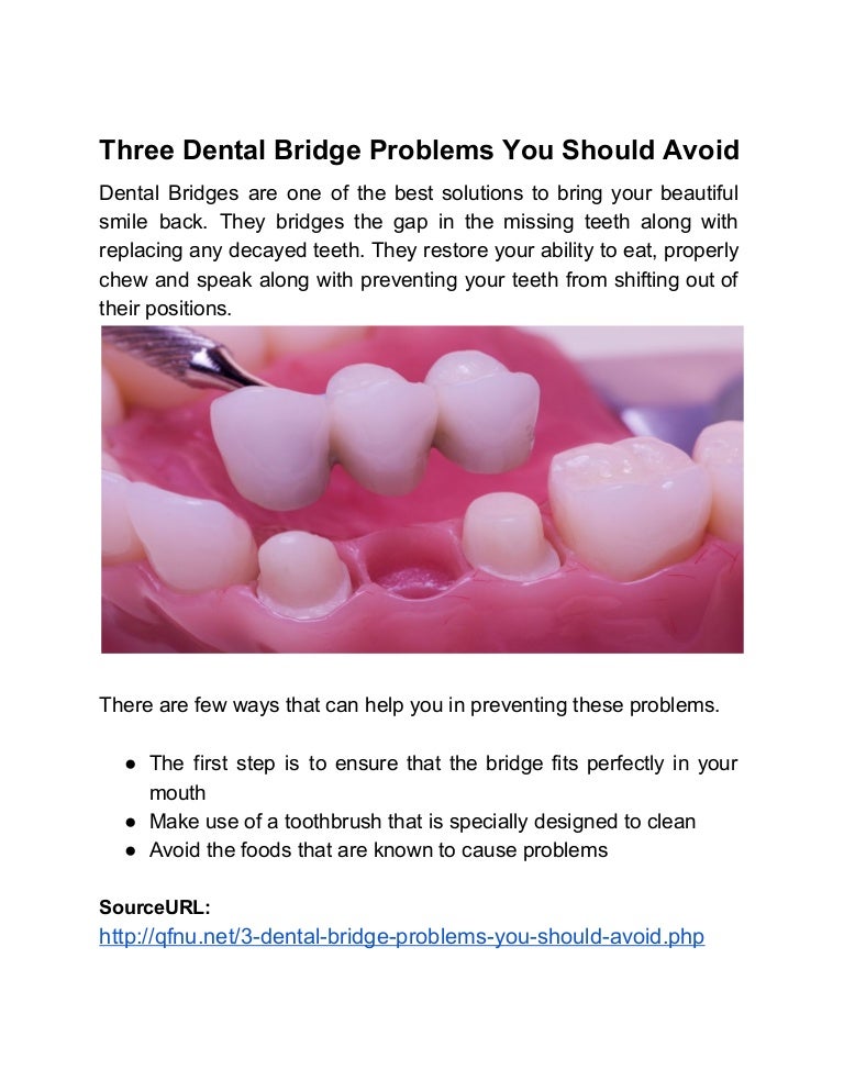 Three dental bridge problems you should avoid