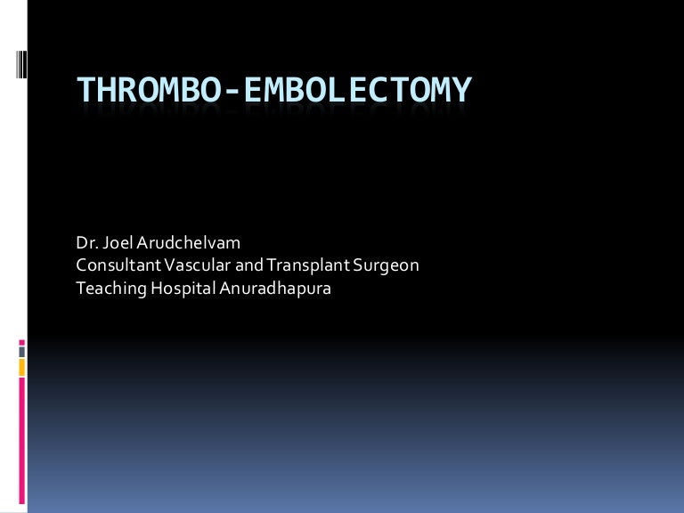 Thrombo embolectomy