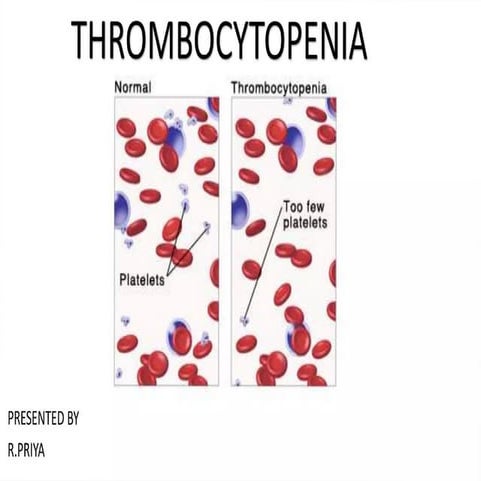 Thrombocytopenia,,,,,,,,,,,,,,,,,,,,,,,,,