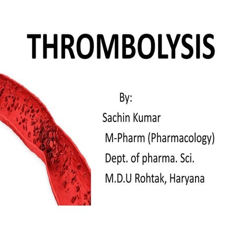 Thrombolysis