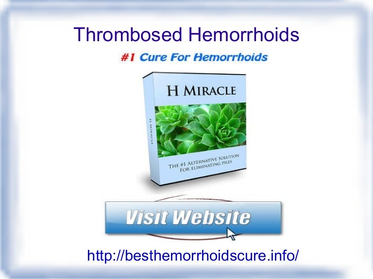 Thrombosed hemorrhoids