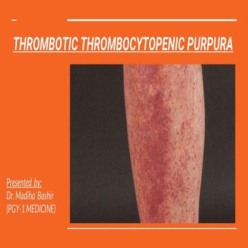 THROMBOTIC THROMBOCYTOPENIC PURPURA (4).pptx