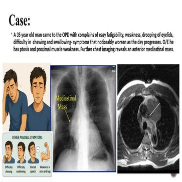 generalidades y tratamiento de cancer de timo | PPTX