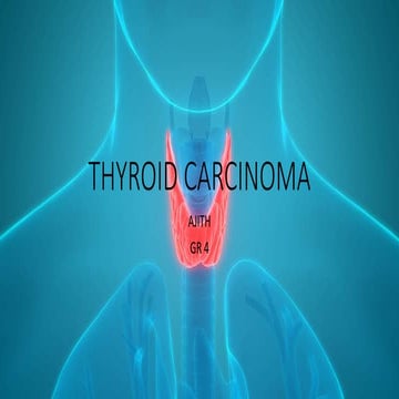 Thyroid carcinoma