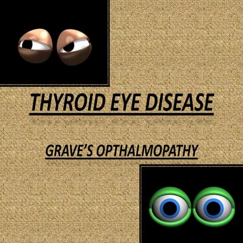 Thyroid eye disease | PPTX