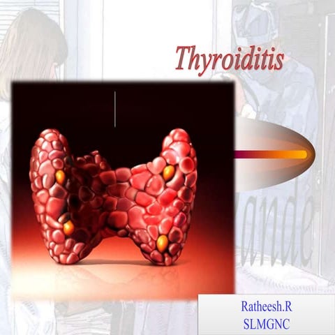 Thyroiditis