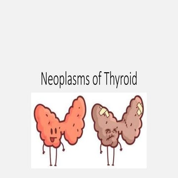 Thyroid neoplasms 