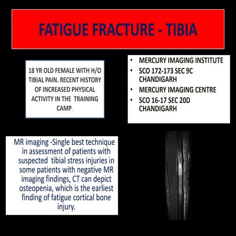 Tibial fracture