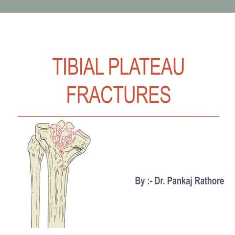 Tibial plateau fractures