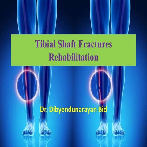 Tibial shaft fractures rehabilitation 
