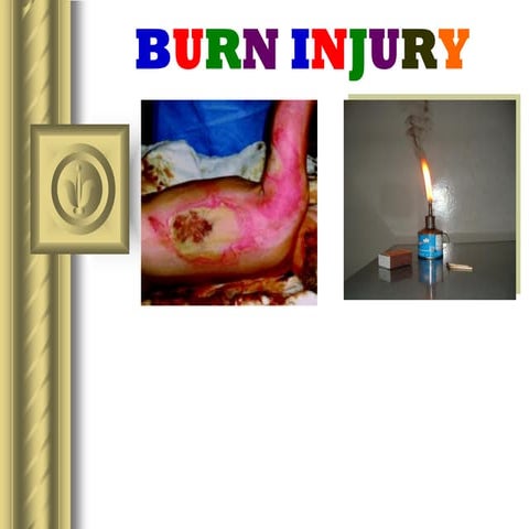 TIDO burn injury for you and others and neighborhood area issues with urio ar...