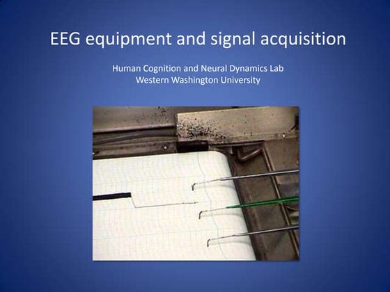 EEG: Basics | PPT