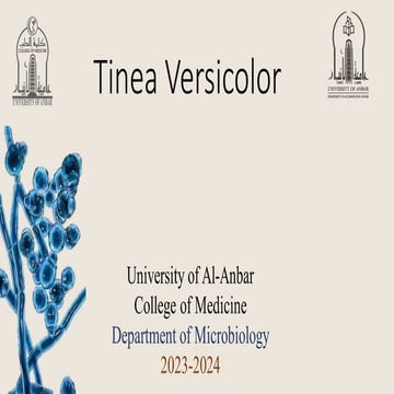 Tinea versicolor (Pityriasis versicolor, is a common fungal infection of the skin)
