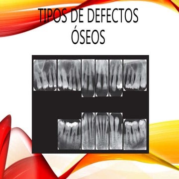 Tipos de defectos óseos, Cirugia resectiva de los tejidos blandos