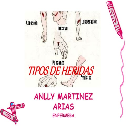 Tipos de heridas