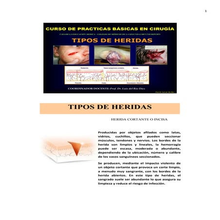 Tipos de heridas. prfo. dr. luis del rio diez