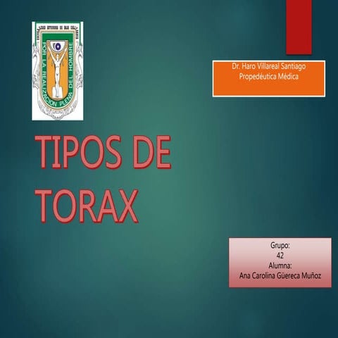 Tipos de torax