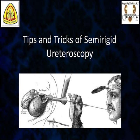 Tips and tricks semirigid urs final