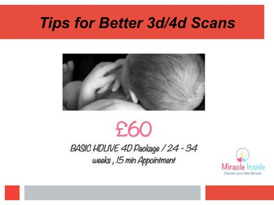 4D scans - your questions answered | PDF | Pregnancy | Reproductive Health