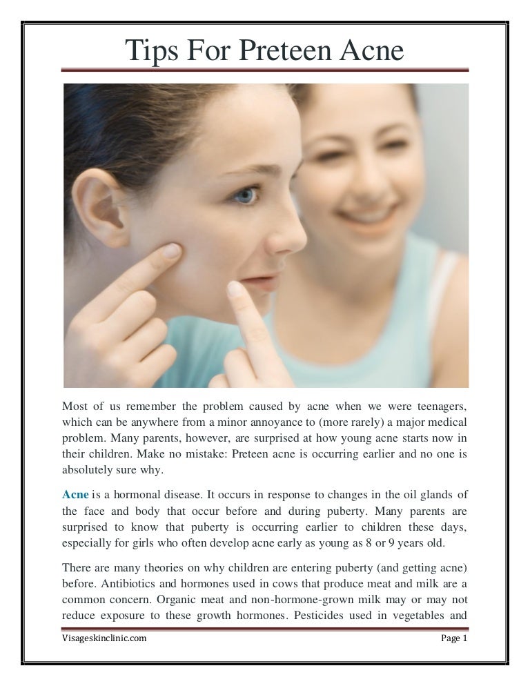 pre teenage acne