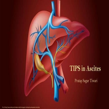 TIPS in Ascites