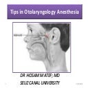 Tips in otolaryngology anesthesia