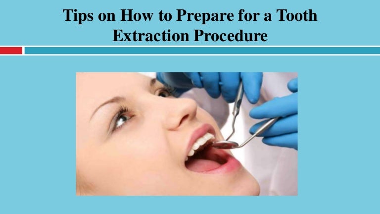 Tooth Extraction Surgery : Tooth Extraction Instructions – UZLI