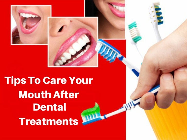 Tips To Care Your Mouth After Dental Treatments
