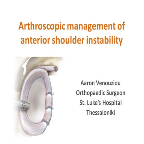 Arthroscopic management of anterior shoulder instability larissa 2016