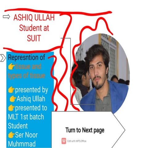Ashiq Anatomy 2nd semistor.pptx