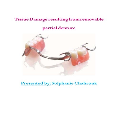 Tissue damage resulting from removable partial denture