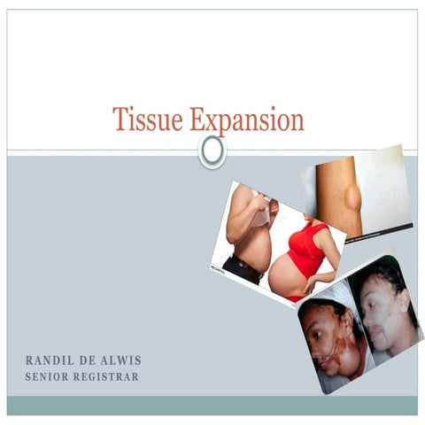 Tissue Expansion , a technique used in plastic surgery | PPTX