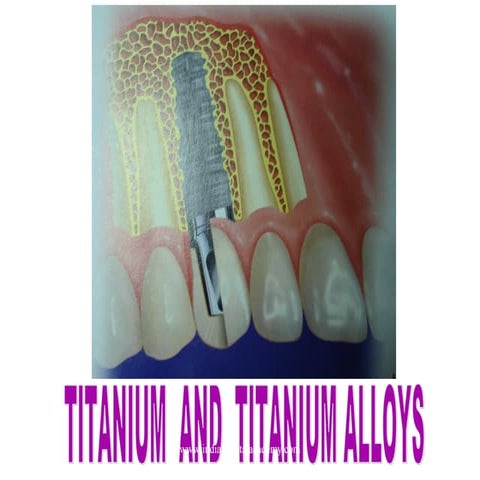 Titanium  and  titanium alloys/ /certified fixed orthodontic courses by India...