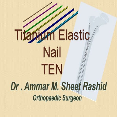 Titanium elastic nail