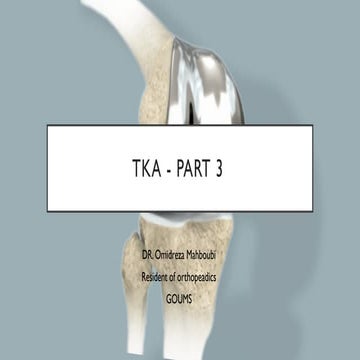 Mechanical principles of Total knee replacement arthroplasty | PPTX