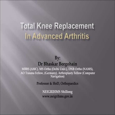Total Knee Replacement (TKR) in advanced arthritis