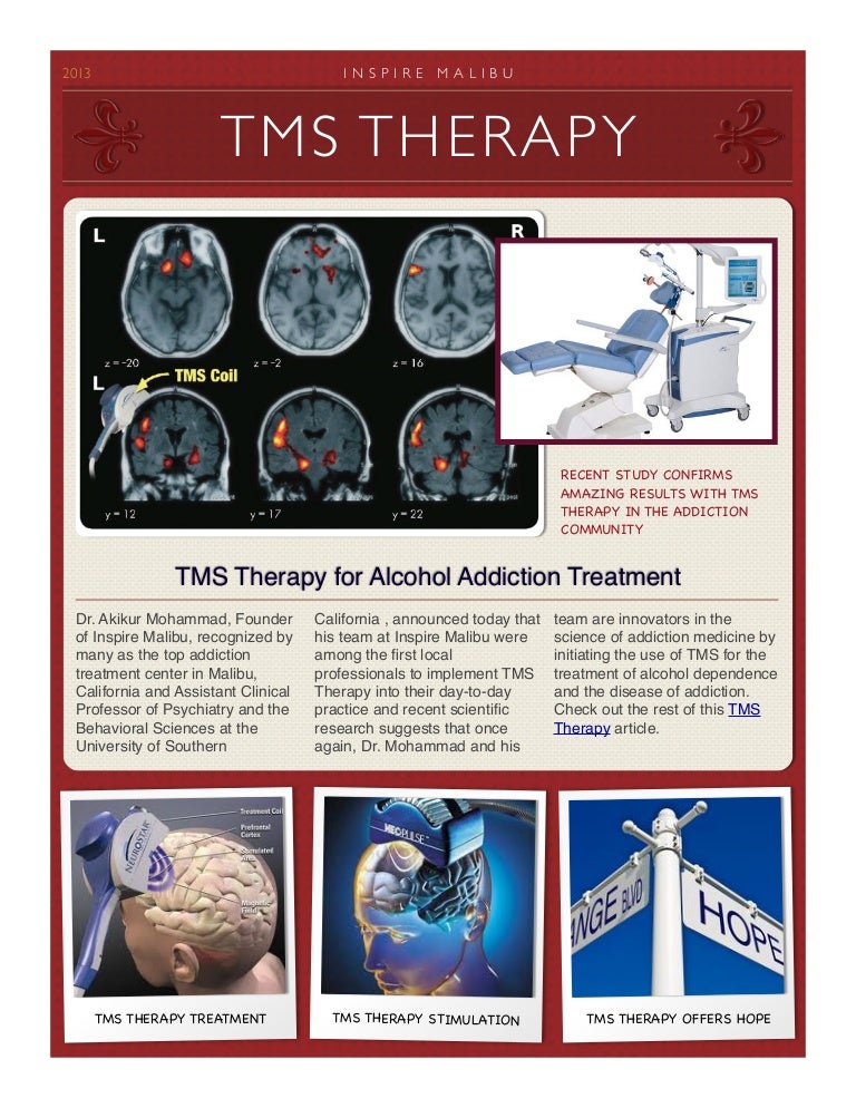 TMS Therapy