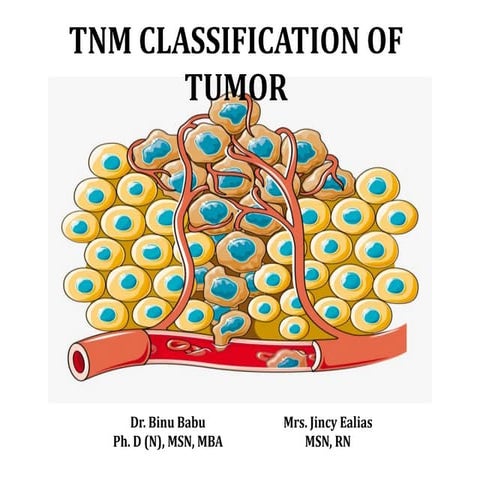 TNM Staging of tumor