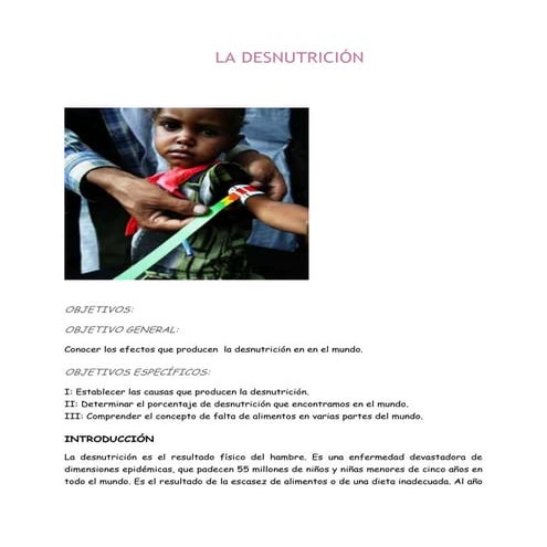 Todo a cerca de la desnutrición