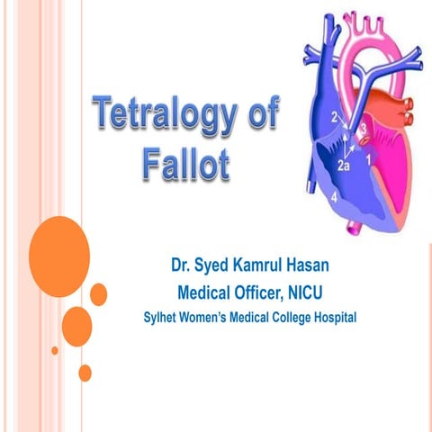  Tetralogy of Fallot (TOF)