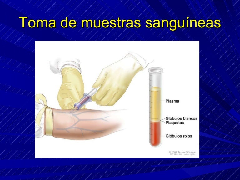 Toma de muestras