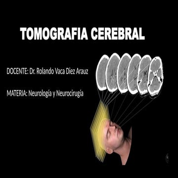 TOMOGRAFIA CE4545353434433resREBRAL.pptx