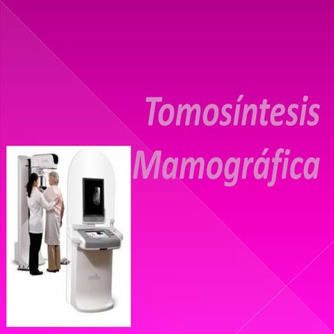 Tomosíntesis mamográfica
