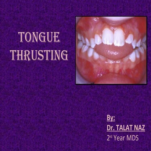 Tongue thrusting - Dr. TALAT NAZ
